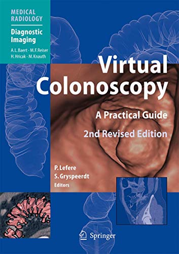 9783540798798: Virtual Colonoscopy: A Practical Guide (Medical Radiology)