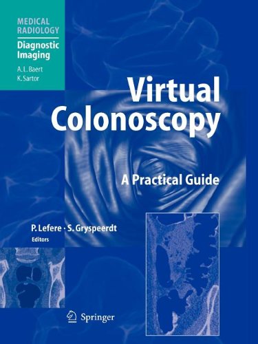 9783540803348: Virtual Colonoscopy