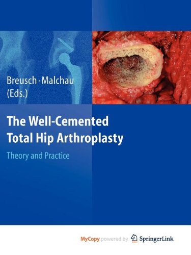 9783540806417: The Well-Cemented Total Hip Arthroplasty: Theory and Practice