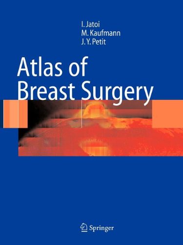 9783540806943: Atlas of Breast Surgery