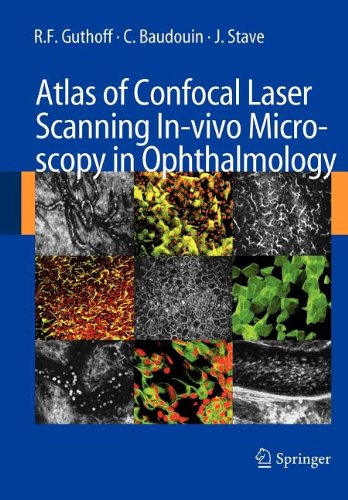 9783540821168: Atlas of Confocal Laser Scanning In-Vivo Microscopy in Ophthalmology