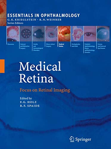 9783540855392: Medical Retina: Focus on Retinal Imaging (Essentials in Ophthalmology)