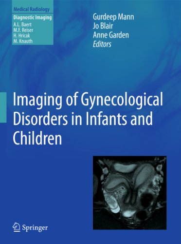 9783540856016: Imaging of Gynecological Disorders in Infants and Children (Medical Radiology)