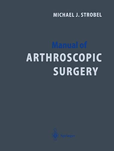 Manual of Arthroscopic Surgery Michael J. Strobel Knee Joint - Ankle Joint - Wrist - Elbow Joint - Shoulder - Subtalar Joint - Joints of the Toes - Joints of the Fingers - Hip Joint - Carpal Tunnel Syndrome - Bursal Endoscopy - Minimally Invasive Endoscopically Assisted Techniques Medizin Pharmazie Klinik Praxis Arthroskopie carpal tunnel syndrome Chirurgie Finger Klinische Fächer Orthopädische Chirurgie This volume details the high-tech standard of arthroscopy. It features 2,300 brilliant figures that illustrate each operative step and includes rare conditions as well and provides detailed information on tricks and pitfalls. The latest knowledge for all those dealing with arthroscopic diagnosis and treatment. A standardised structure of the individual chapters facilitates the retrieval of information: diagnosis, therapeutic management including decision-making for conservative and operative treatment, arthroscopic results and surgical techniques. The latter are described in a practica - Michael Strobel (Autor)