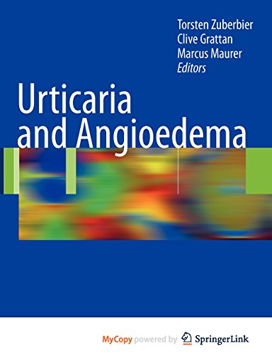 9783540871767: Urticaria and Angioedema