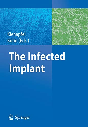 9783540928355: The Infected Implant