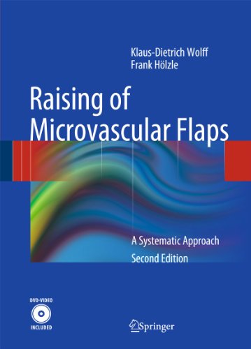 9783540938316: Raising of Microvascular Flaps: A Systemic Approach