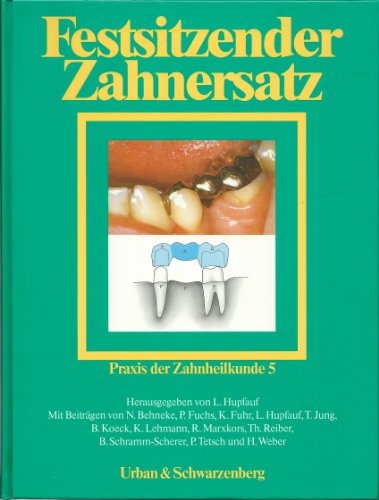 Festsitzender Zahnersatz