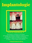 Beispielbild fr Praxis der Zahnheilkunde, 13 Bde. in 15 Tl.-Bdn., Bd.13, Implantologie zum Verkauf von medimops