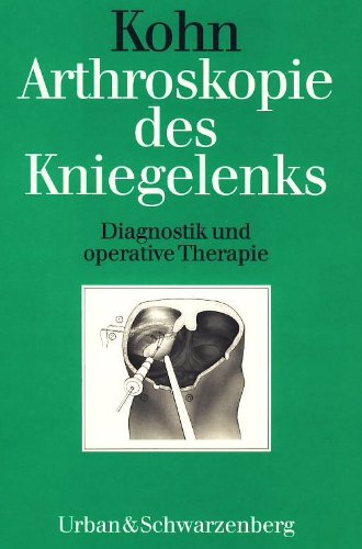 Stock image for Arthroskopie des Kniegelenks. Diagnostik und operative Therapie. for sale by Antiquariat Bcherkeller