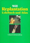 9783541178216: Replantation von Zhnen - Will, Rolf