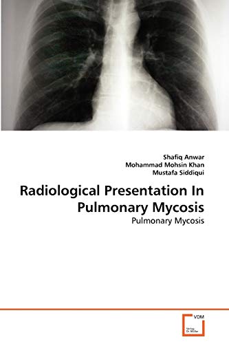 Imagen de archivo de Radiological Presentation In Pulmonary Mycosis: Pulmonary Mycosis a la venta por Lucky's Textbooks