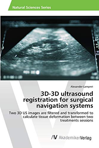 Stock image for 3D-3D ultrasound registration for surgical navigation systems for sale by Chiron Media