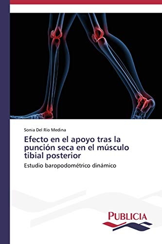 9783639555684: Efecto en el apoyo tras la puncin seca en el msculo tibial posterior: Estudio baropodomtrico dinmico (Spanish Edition)