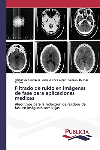 Imagen de archivo de Filtrado de ruido en imagenes de fase para aplicaciones medicas a la venta por Chiron Media