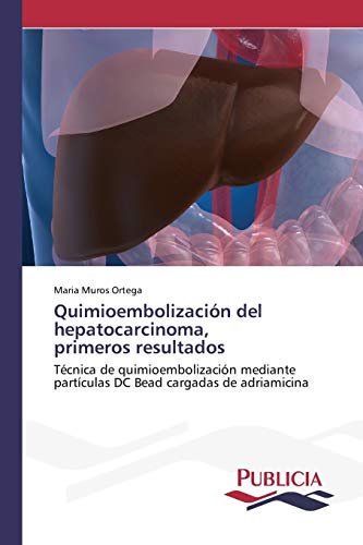 Imagen de archivo de Quimioembolizacion del hepatocarcinoma, primeros resultados a la venta por Chiron Media