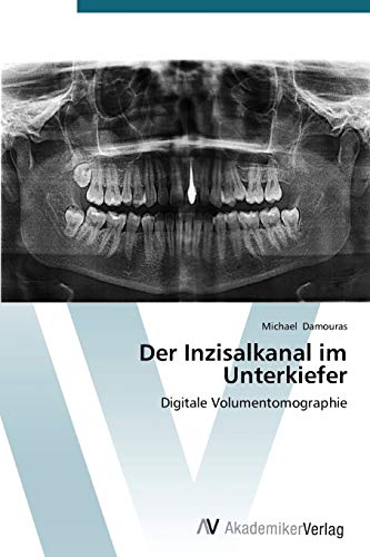 9783639678048: Der Inzisalkanal im Unterkiefer: Digitale Volumentomographie