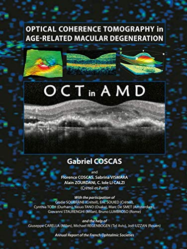 Stock image for Optical Coherence Tomography in Age-Related Macular Degeneration for sale by arcfoundationthriftstore