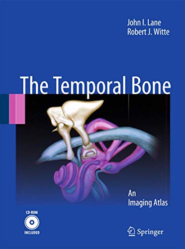 Stock image for Temporal Bone: An Imaging Atlas for sale by CSG Onlinebuch GMBH