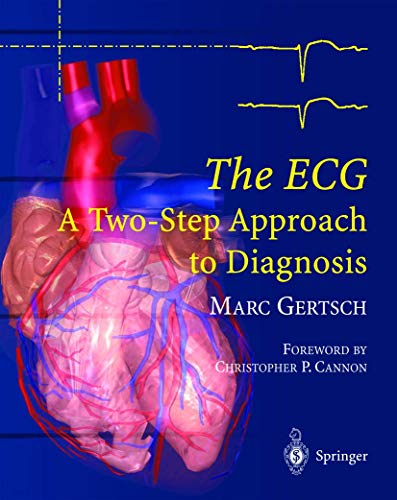 9783642056567: The ECG: A Two-Step Approach to Diagnosis