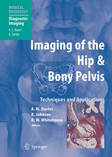 Stock image for Imaging of the Hip & Bony Pelvis: Techniques and Applications (Medical Radiology / Diagnostic Imaging) for sale by Revaluation Books