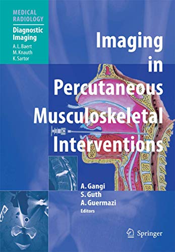 Beispielbild fr Imaging in Percutaneous Musculoskeletal Interventions (Diagnostic Imaging) zum Verkauf von Lucky's Textbooks