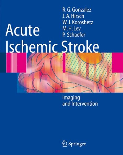 9783642064425: Acute Ischemic Stroke: Imaging and Intervention