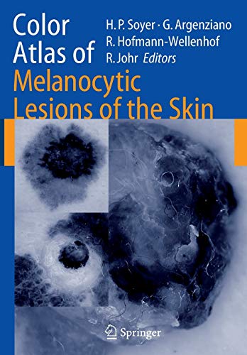 9783642071201: Color Atlas of Melanocytic Lesions of the Skin