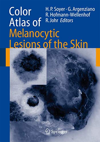 9783642071201: Color Atlas of Melanocytic Lesions of the Skin