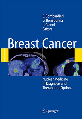 9783642071867: Breast Cancer: Nuclear Medicine in Diagnosis and Therapeutic Options