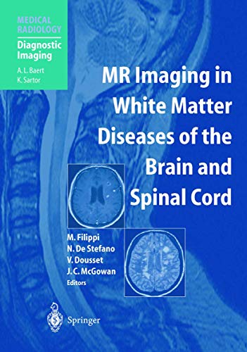 9783642072987: MR Imaging in White Matter Diseases of the Brain and Spinal Cord