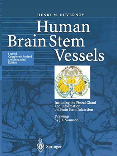 9783642084027: Human Brain Stem Vessels: Including the Pineal Gland and Information on Brain Stem Infarction