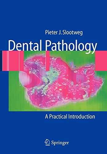 9783642090813: Dental Pathology: A Practical Introduction