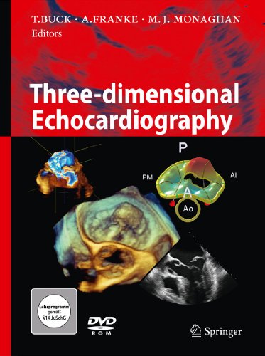 9783642111785: Three-dimensional Echocardiography