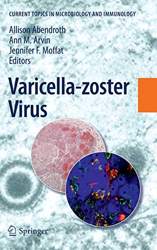 9783642127274: Varicella-zoster Virus: 342 (Current Topics in Microbiology and Immunology, 342)