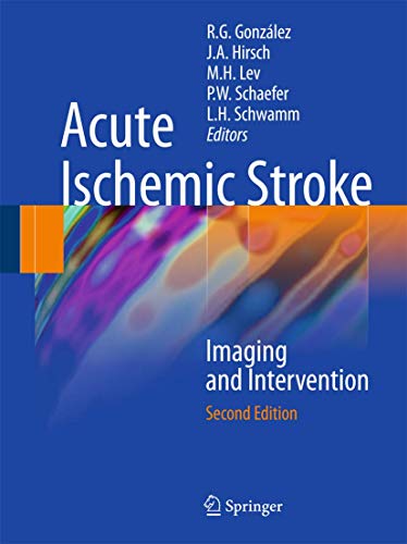 Acute Ischemic Stroke. Imaging and Intervention.