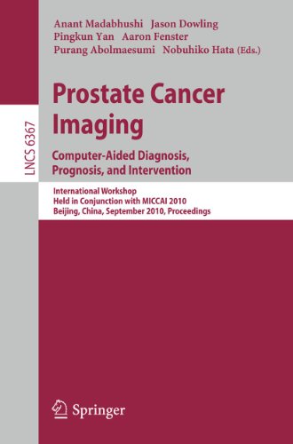 Stock image for Prostate Cancer Imaging: Computer-Aided Diagnosis, Prognosis, and Intervention Image Processing, Computer Vision, Pattern Recognition, and Graphics for sale by Blackwell's