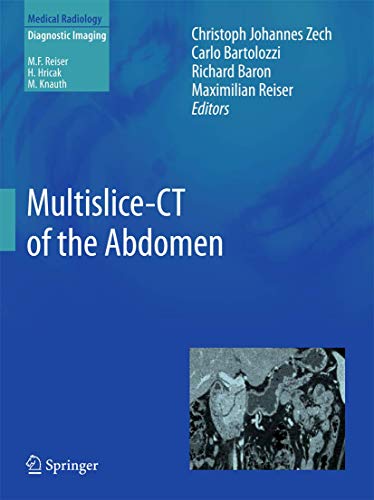 Stock image for Multislice-CT of the Abdomen(Medical Radiology / Diagnostic Imaging (Englisch) Medizinische Fachgebiete Radiologie Bildgebende Verfahren Radiologe Bauch Buche Abdomen bowel Computed tomography Computertomographie Computertomographie CT Liver pancreas spleen Christoph Johannes Zech (Herausgeber), Carlo Bartolozzi (Herausgeber), Richard Baron (Herausgeber), Maximilian F. Reiser (Herausgeber) for sale by BUCHSERVICE / ANTIQUARIAT Lars Lutzer