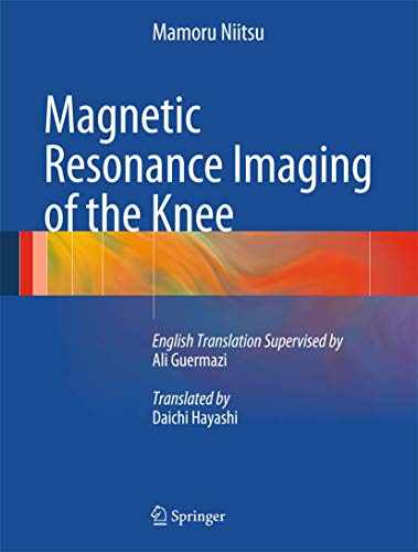 Beispielbild fr Magnetic Resonance Imaging of the Knee [Englisch] [Gebundene Ausgabe] Mamoru Niitsu (Autor), Ali Guermazi (Regisseur), Daichi Hayashi (bersetzer) zum Verkauf von BUCHSERVICE / ANTIQUARIAT Lars Lutzer