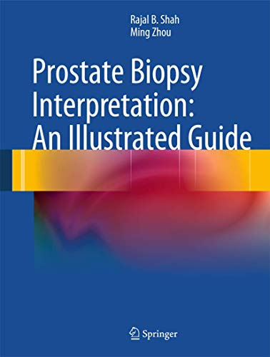 Stock image for Prostate Biopsy Interpretation: An Illustrated Guide for sale by HPB-Red