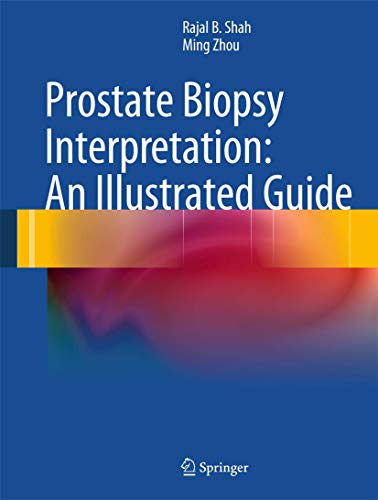 9783642213687: Prostate Biopsy Interpretation: An Illustrated Guide