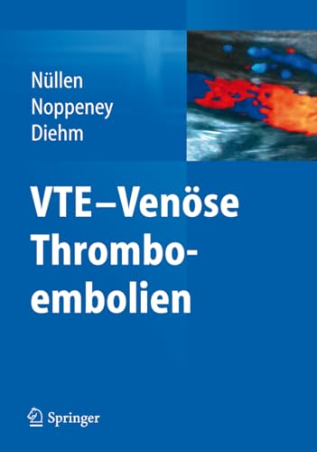 Beispielbild fr VTE - Vense Thromboembolien zum Verkauf von Blackwell's