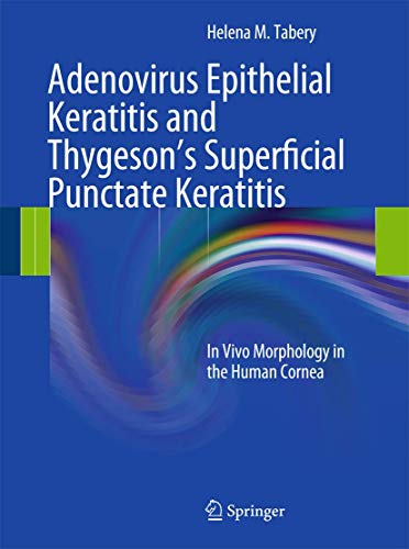 Adenovirus Epithelial Keratitis and Thygeson s Superficial Punctate Keratitis: In Vivo Morphology...