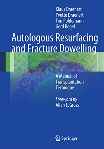 9783642249105: Autologous Resurfacing and Fracture Dowelling: A Manual of Transplantation Technique