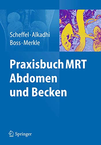Stock image for Praxisbuch MRT Abdomen und Becken (German Edition) for sale by GF Books, Inc.