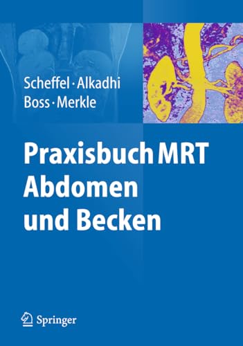 9783642253393: Praxisbuch MRT Abdomen und Becken (German Edition)