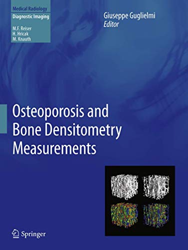 Beispielbild fr Osteoporosis and Bone Densitometry Measurements (Medical Radiology) zum Verkauf von Versandantiquariat Ursula Ingenhoff