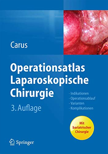 Beispielbild fr Operationsatlas Laparoskopische Chirurgie: Indikationen - Operationsablauf - Varianten - Komplikationen (German Edition) zum Verkauf von Brook Bookstore