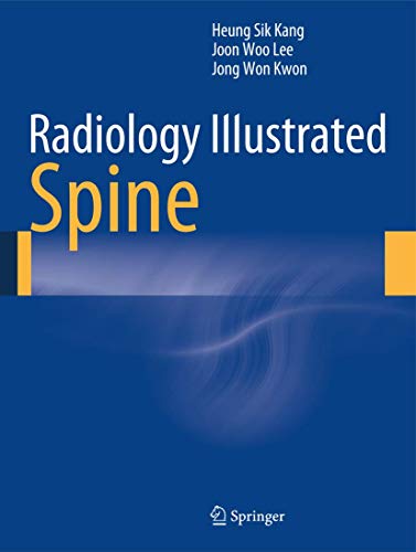 Stock image for Radiology Illustrated: Spine for sale by Mispah books