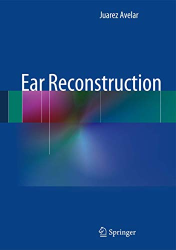 9783642356827: Ear Reconstruction